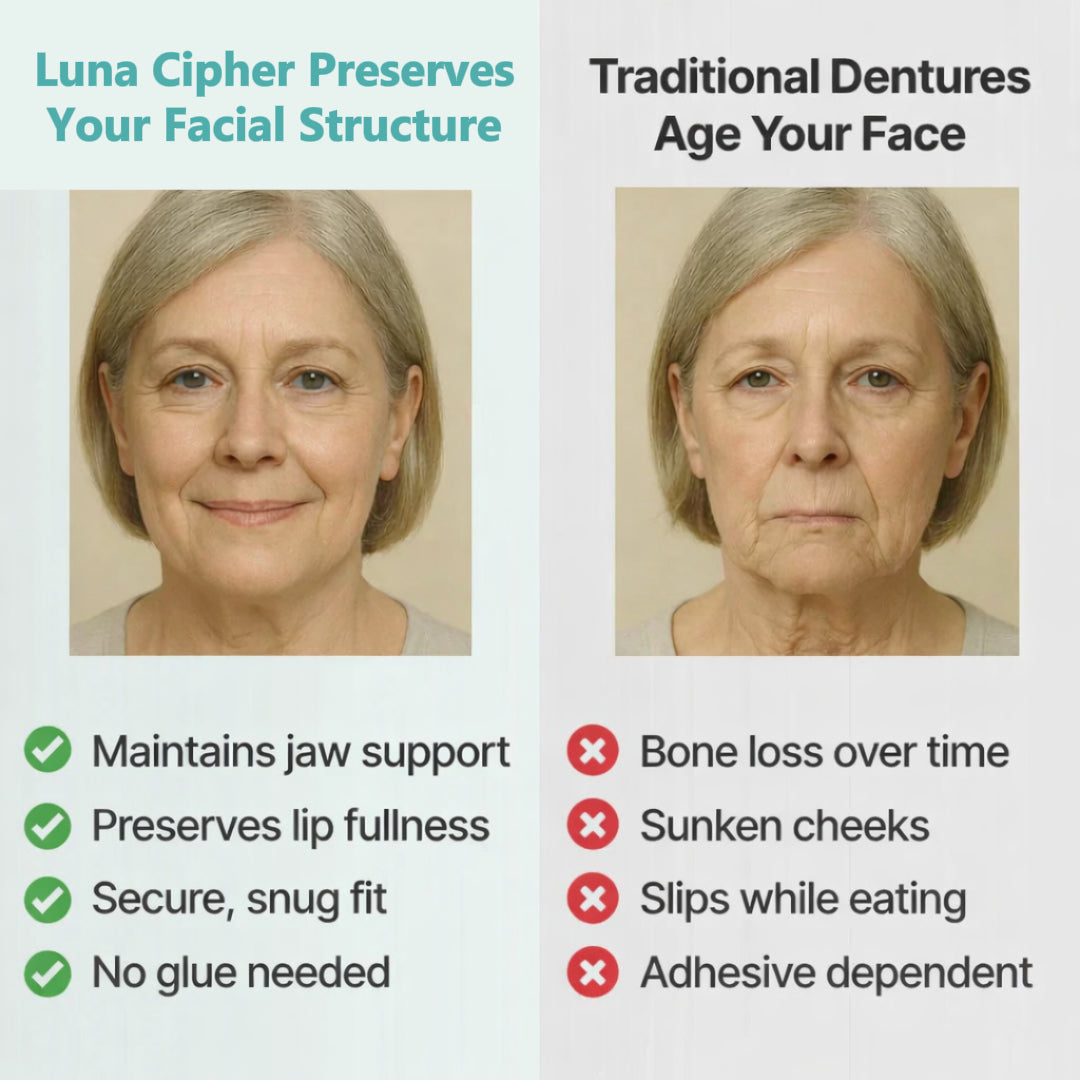 👑2026 Eaily Hot Sale Ends Today: 70% OFF! Luna Cipher Custom Custom-Fit Full Functional DenturesMake you more confident