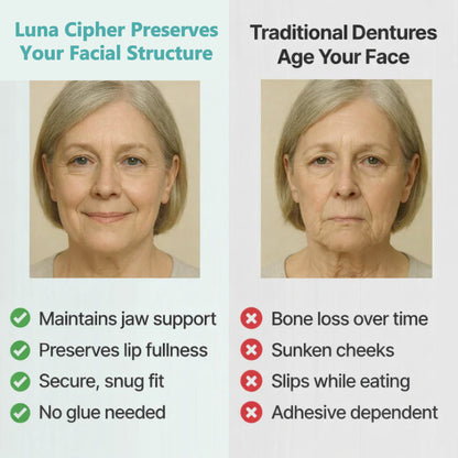 👑2026 Eaily Hot Sale Ends Today: 70% OFF! Luna Cipher Custom Custom-Fit Full Functional DenturesMake you more confident