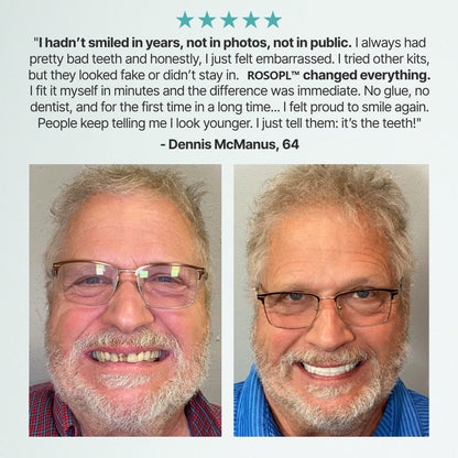 🦷HazyGalaxy™ Custom-Fit Functional Dentures — Up to 70% OFF for a More Confident Smile!