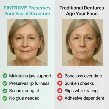 Viralaluna Quick Fit Dentures