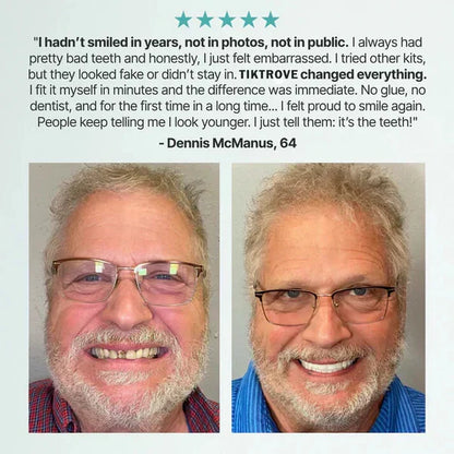 Viralaluna Quick Fit Dentures