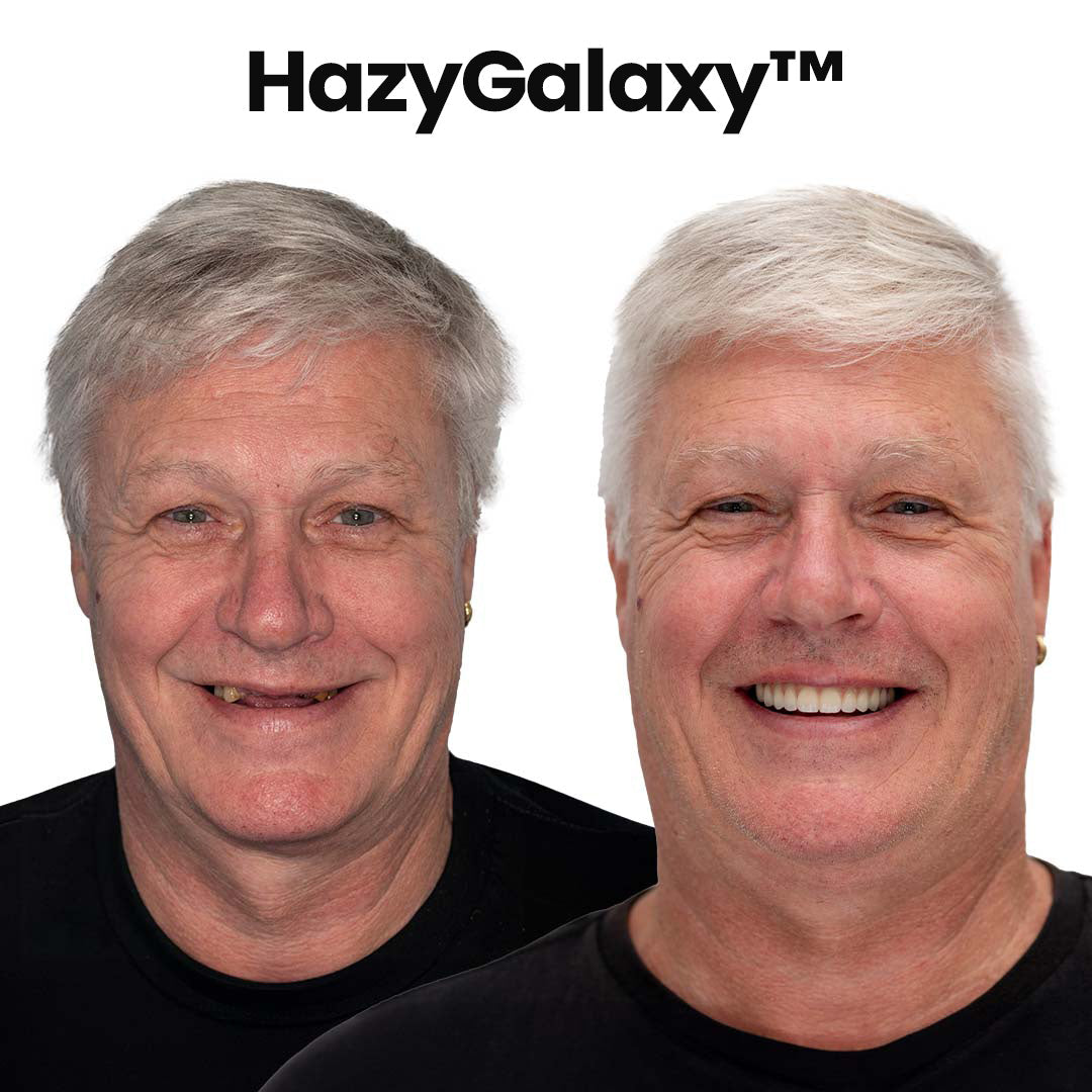 🦷HazyGalaxy™ Custom-Fit Functional Dentures — Up to 70% OFF for a More Confident Smile!