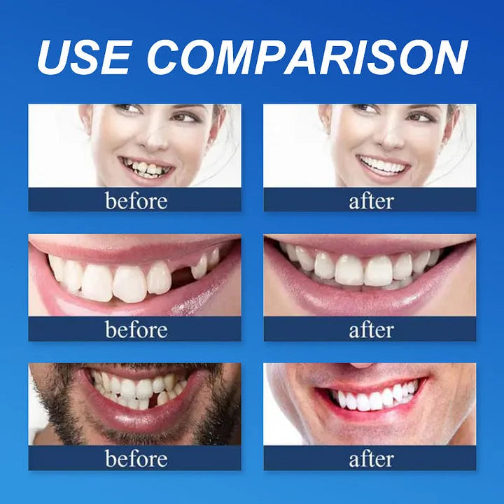 -Ends Today: 70% OFF! ⏰HazyGalaxy™  Medical Full Denture with Strong Suctiond Custom-Fit Full Functional Dentures🦷