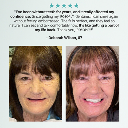🦷HazyGalaxy™ Custom-Fit Functional Dentures — Up to 70% OFF for a More Confident Smile!