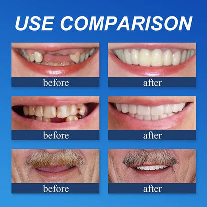-Ends Today: 75% OFF! ⏰DarkFairy™ Medical Full Denture with Strong Suctiond Custom-Fit Full Functional Dentures🦷